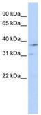 Nuclear Receptor Subfamily 1 Group I Member 3 antibody, TA338327, Origene, Western Blot image 