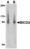 BICD Cargo Adaptor 2 antibody, TA306603, Origene, Western Blot image 