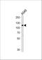 BicC Family RNA Binding Protein 1 antibody, A06638, Boster Biological Technology, Western Blot image 