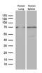 Arachidonate 5-lipoxygenase antibody, TA806885S, Origene, Western Blot image 
