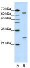 Nudix Hydrolase 21 antibody, TA345992, Origene, Western Blot image 
