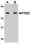 Phosphotriesterase Related antibody, A08763, Boster Biological Technology, Western Blot image 
