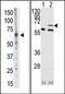 Matrix Metallopeptidase 14 antibody, AP13171PU-N, Origene, Western Blot image 
