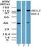 Ubiquitin Like Modifier Activating Enzyme 6 antibody, TA336995, Origene, Western Blot image 