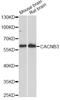 Calcium Voltage-Gated Channel Auxiliary Subunit Beta 3 antibody, A14710, ABclonal Technology, Western Blot image 