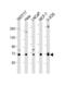 GBA antibody, PA5-72598, Invitrogen Antibodies, Western Blot image 