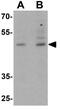 POU Class 3 Homeobox 2 antibody, GTX31506, GeneTex, Western Blot image 