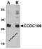 Coiled-coil domain-containing protein 106 antibody, 5865, ProSci, Western Blot image 