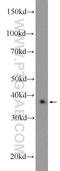 CXXC Finger Protein 5 antibody, 16513-1-AP, Proteintech Group, Western Blot image 