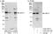 Ubiquitin carboxyl-terminal hydrolase 13 antibody, A302-763A, Bethyl Labs, Immunoprecipitation image 