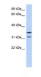 Elongator Acetyltransferase Complex Subunit 5 antibody, orb325883, Biorbyt, Western Blot image 