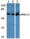 LIM Domain Kinase 1 antibody, PA5-36062, Invitrogen Antibodies, Western Blot image 