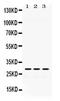 2-Aminoethanethiol Dioxygenase antibody, PA5-78733, Invitrogen Antibodies, Western Blot image 