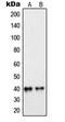 Peroxisomal Biogenesis Factor 7 antibody, LS-C352638, Lifespan Biosciences, Western Blot image 