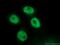 Splicing Factor 3a Subunit 3 antibody, 12070-1-AP, Proteintech Group, Immunofluorescence image 