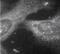 Presenilin 1 antibody, ab15456, Abcam, Immunocytochemistry image 