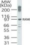 TNF Receptor Superfamily Member 11a antibody, TA336348, Origene, Western Blot image 