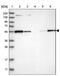 Major Facilitator Superfamily Domain Containing 11 antibody, PA5-54547, Invitrogen Antibodies, Western Blot image 