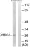 Dehydrogenase/reductase SDR family member 2 antibody, LS-C119898, Lifespan Biosciences, Western Blot image 