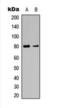 Coagulation Factor XIII B Chain antibody, orb393280, Biorbyt, Western Blot image 
