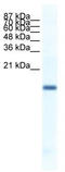 Fer3-like protein antibody, TA341498, Origene, Western Blot image 