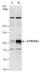 ATPase H+ Transporting V0 Subunit A2 antibody, TA308549, Origene, Western Blot image 