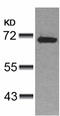 Zeta Chain Of T Cell Receptor Associated Protein Kinase 70 antibody, TA323317, Origene, Western Blot image 