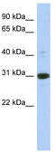 Inositol Monophosphatase 1 antibody, TA344233, Origene, Western Blot image 