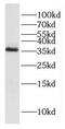 3-Ketodihydrosphingosine Reductase antibody, FNab04515, FineTest, Western Blot image 