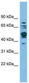 Serine hydroxymethyltransferase, cytosolic antibody, TA330971, Origene, Western Blot image 