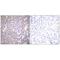Claudin 2 antibody, A03033, Boster Biological Technology, Immunohistochemistry paraffin image 