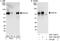 E3 ubiquitin-protein ligase RAD18 antibody, A301-340A, Bethyl Labs, Immunoprecipitation image 