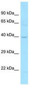 Serine/threonine-protein kinase DCLK1 antibody, TA338176, Origene, Western Blot image 