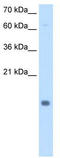 Stefin-B antibody, TA338387, Origene, Western Blot image 