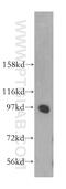 Serine/threonine-protein kinase D2 antibody, 11623-1-AP, Proteintech Group, Western Blot image 