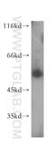Peroxisomal N(1)-acetyl-spermine/spermidine oxidase antibody, 18972-1-AP, Proteintech Group, Western Blot image 