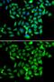 Cytoplasmic Linker Associated Protein 1 antibody, GTX33099, GeneTex, Immunocytochemistry image 