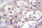 Serine/threonine-protein kinase B-raf antibody, AP06501PU-N, Origene, Immunohistochemistry frozen image 