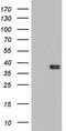 Ornithine Carbamoyltransferase antibody, TA802682AM, Origene, Western Blot image 