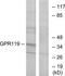 Glucose-dependent insulinotropic receptor antibody, TA312500, Origene, Western Blot image 