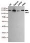 Janus Kinase 1 antibody, STJ99138, St John