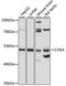Choline Kinase Alpha antibody, LS-C750015, Lifespan Biosciences, Western Blot image 