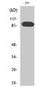 Rho guanine nucleotide exchange factor 19 antibody, STJ91688, St John