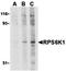 Limpii antibody, orb20222, Biorbyt, Western Blot image 