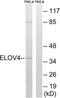 ELOVL Fatty Acid Elongase 4 antibody, LS-C119953, Lifespan Biosciences, Western Blot image 