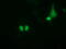 Pseudouridine Synthase 7 antibody, M13434, Boster Biological Technology, Immunofluorescence image 
