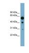 Rho GTPase-activating protein 15 antibody, NBP1-56885, Novus Biologicals, Western Blot image 