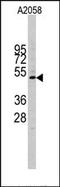 Cyclin E1 antibody, AP13251PU-N, Origene, Western Blot image 