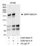 Fanconi anemia group J protein antibody, A300-560A, Bethyl Labs, Immunoprecipitation image 