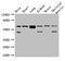 Protein Kinase AMP-Activated Catalytic Subunit Alpha 2 antibody, LS-C679160, Lifespan Biosciences, Western Blot image 